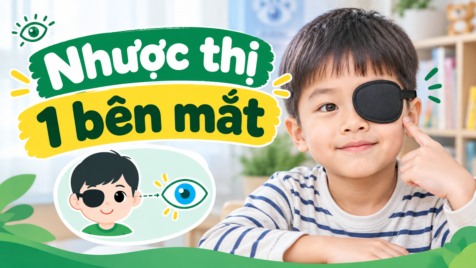 Nhược thị 1 bên mắt phải làm thế nào